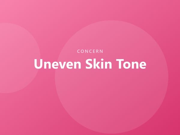 Uneven Skin Tone